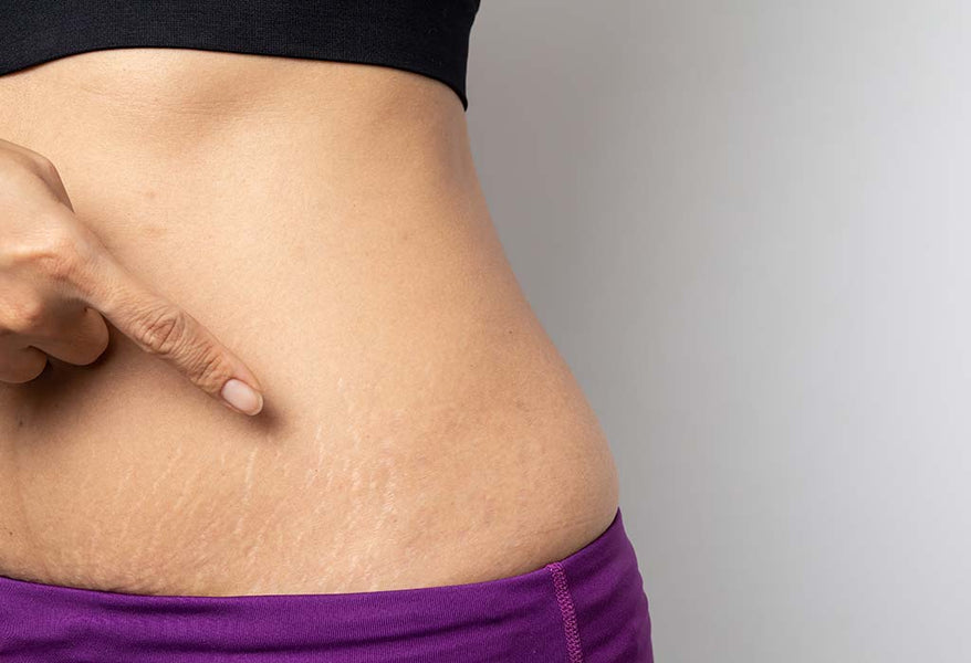 Dealing with bodily changes becomes quite commonplace once you become pregnant, and even after having your baby